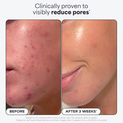 Paula's Choice SKIN PERFECTING 2% BHA Liquid Salicylic Acid Exfoliant Duo, Gentle Exfoliator for Enlarged Pores, Wrinkles & Fine Lines, Includes 1 Full Size Bottle & 1 Travel Size Bottle 🍁 All In One Marketplace Canada