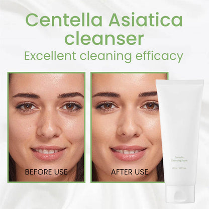 Mixsoon Centella Cleansing Foam 150ml